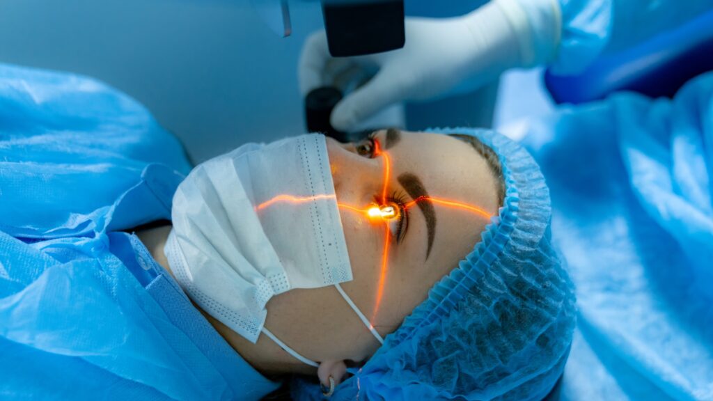 Cataract Surgery