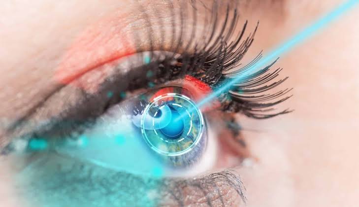 Who Is A Suitable Candidate For Eye Surgery Lasik Procedures?